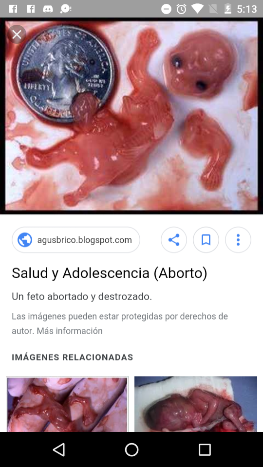 Sos Un Suicida?