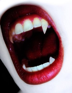 kiss