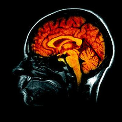 Test Intelligence