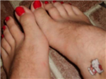 Hairy Feet
