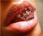 Kisses
