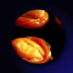 Dea Creamy with Almonds