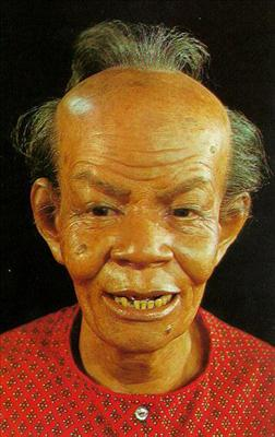 หัวคุณ "เถิก" แค่ไหน