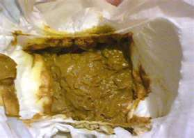diarea poopy