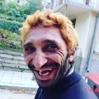 Salak Mısın?