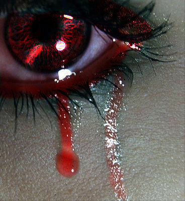 BROKEN HEART