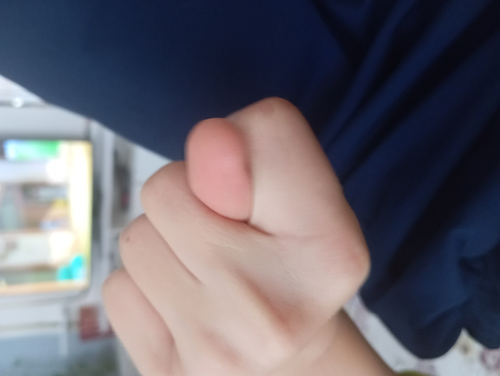 Embiyanın testi